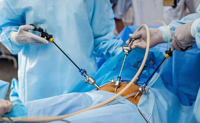 STOMACH REDUCTION OPERATION TURKEY