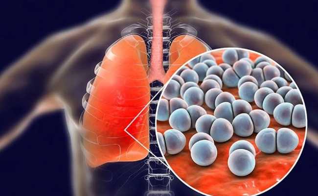 STREP VIRUS INFECTION