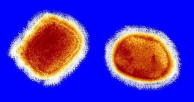 MONKEYPOX OUTBREAK