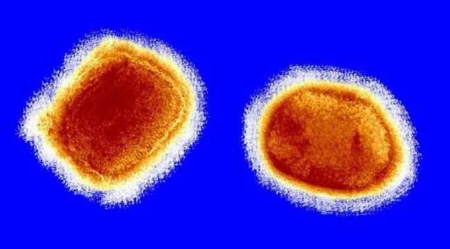 MONKEYPOX OUTBREAK