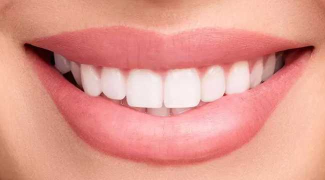 dentist in turkey